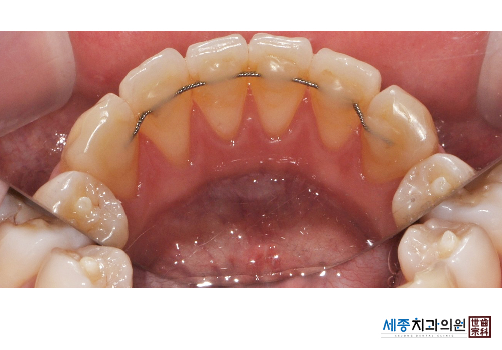 한은서_8089 후(수정).jpg