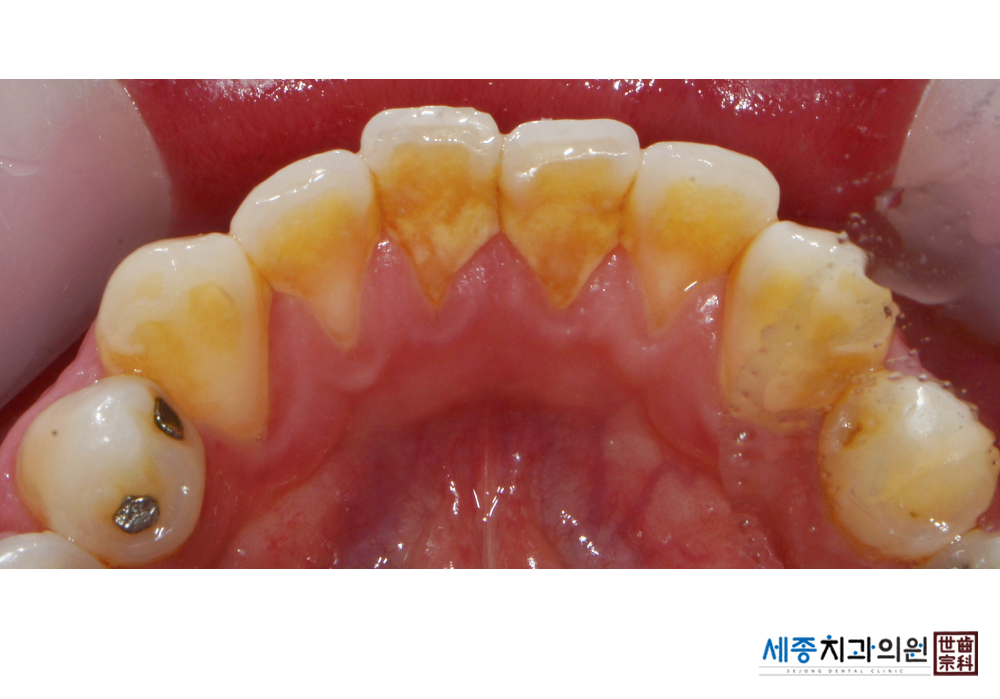 8fda1b5b0e2079c56a4e5eb57f2f88b1.jpg