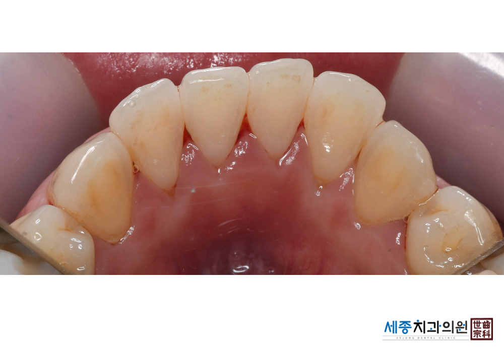 전보경(후 수정)_d17_20200325_193228000.jpg