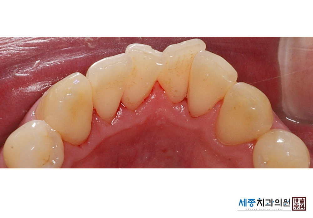 김용우(전 수정)_d11_20141211_114934000.jpg