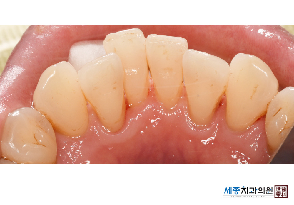 권희선(후 수정)_d13_20200214_112146000.jpg