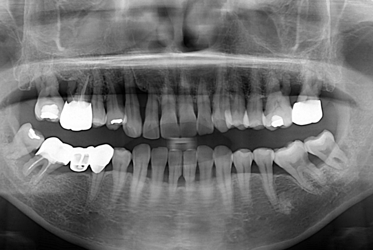 240912967324fcd9950a0f6aa75506c5.jpg
