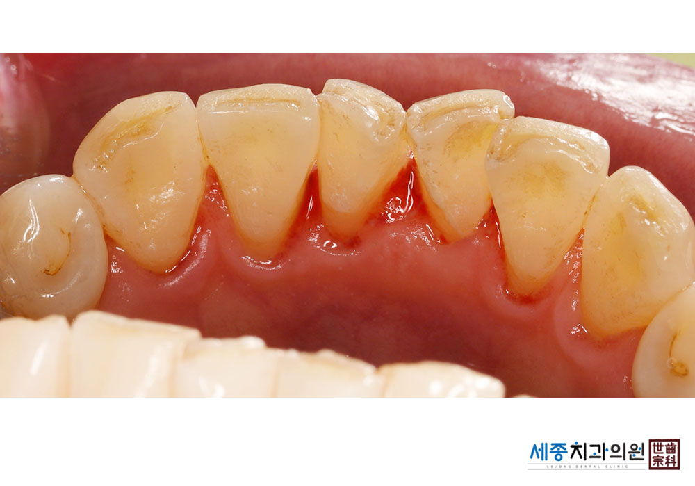 하순화_20240214_151426.jpg