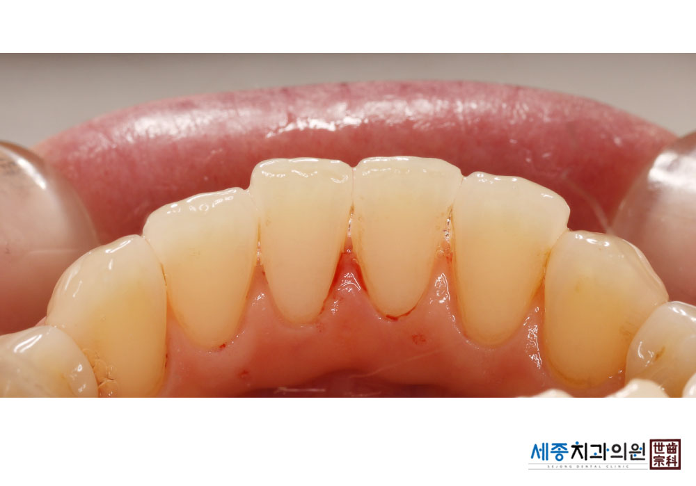 강재이_20240729_163001.jpg