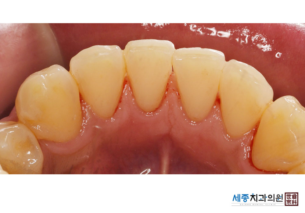 허원석_20231122_142646.jpg