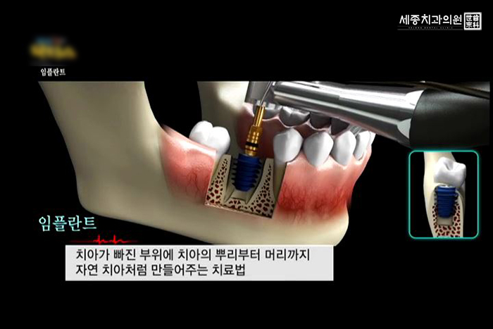 ㄱ-9.jpg