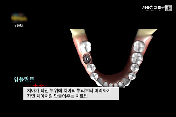 ㄱ-10.jpg
