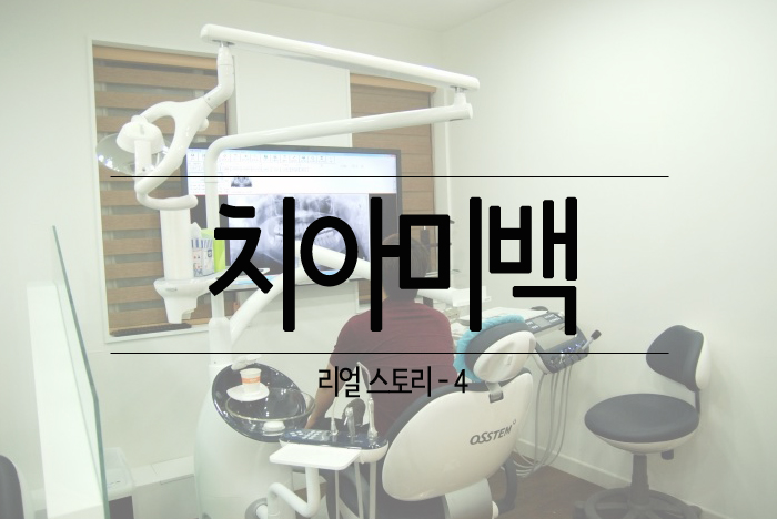 치아미백 리얼스토리4.jpg
