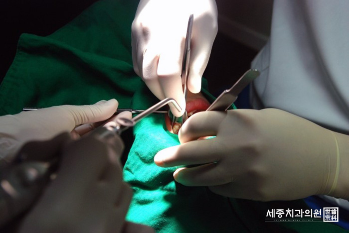 사랑니발치 리얼스토리6.jpg