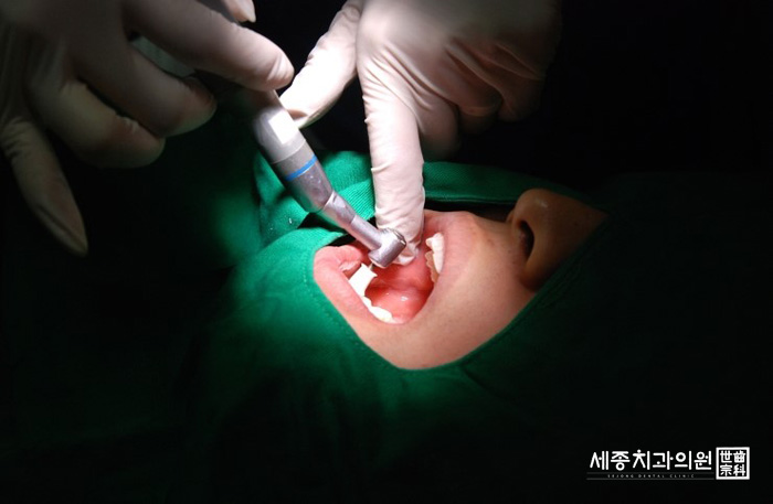 스케일링 리얼스토리2.jpg