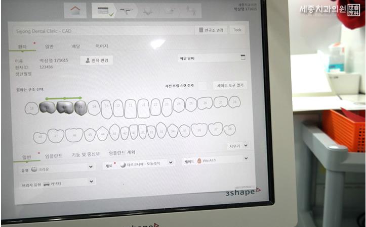 구강스캐너 (2).jpg